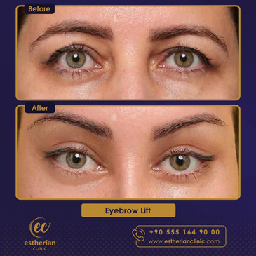 Slider image (10) Estherian Clinic